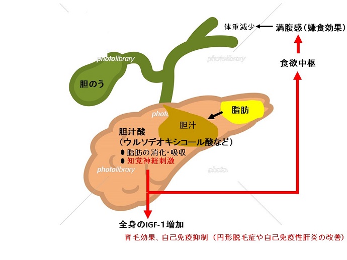 円形脱毛症　病院